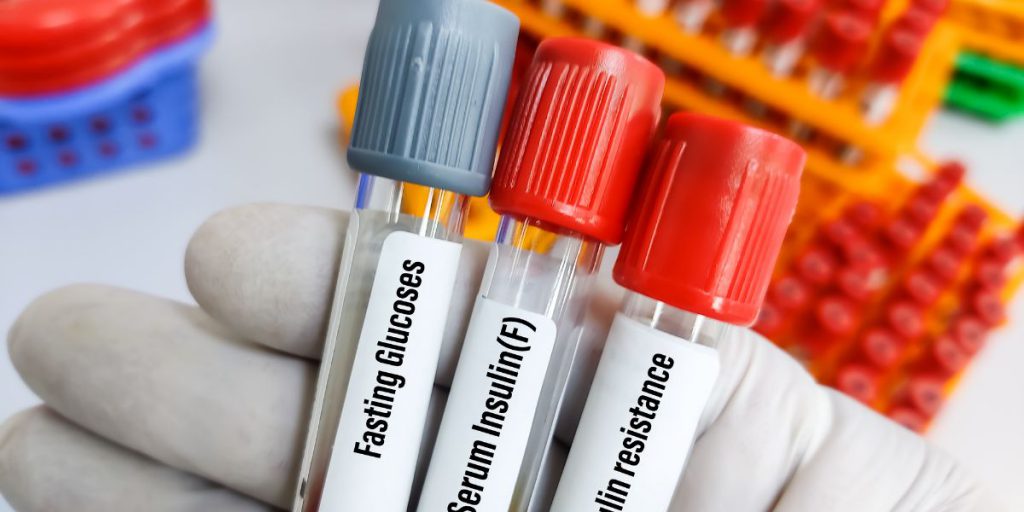 impaired-fasting-glycemia-ifg-impaired-fasting-glucose