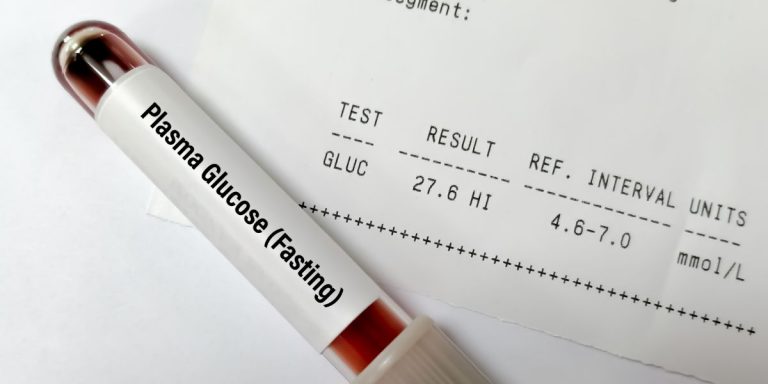 fasting-plasma-glucose-test