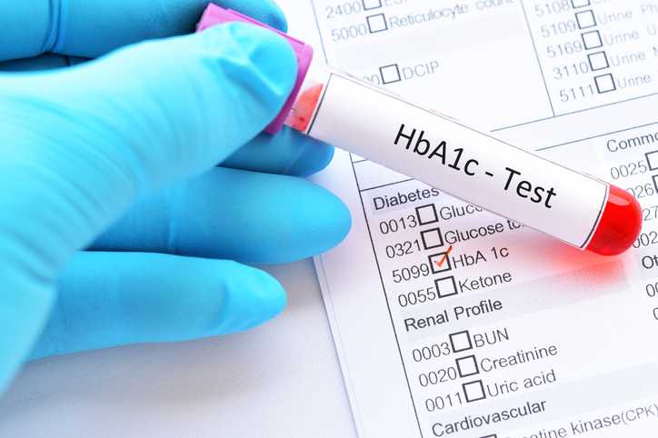 What Is Hba1c Definitio Units Conversio Testing Control